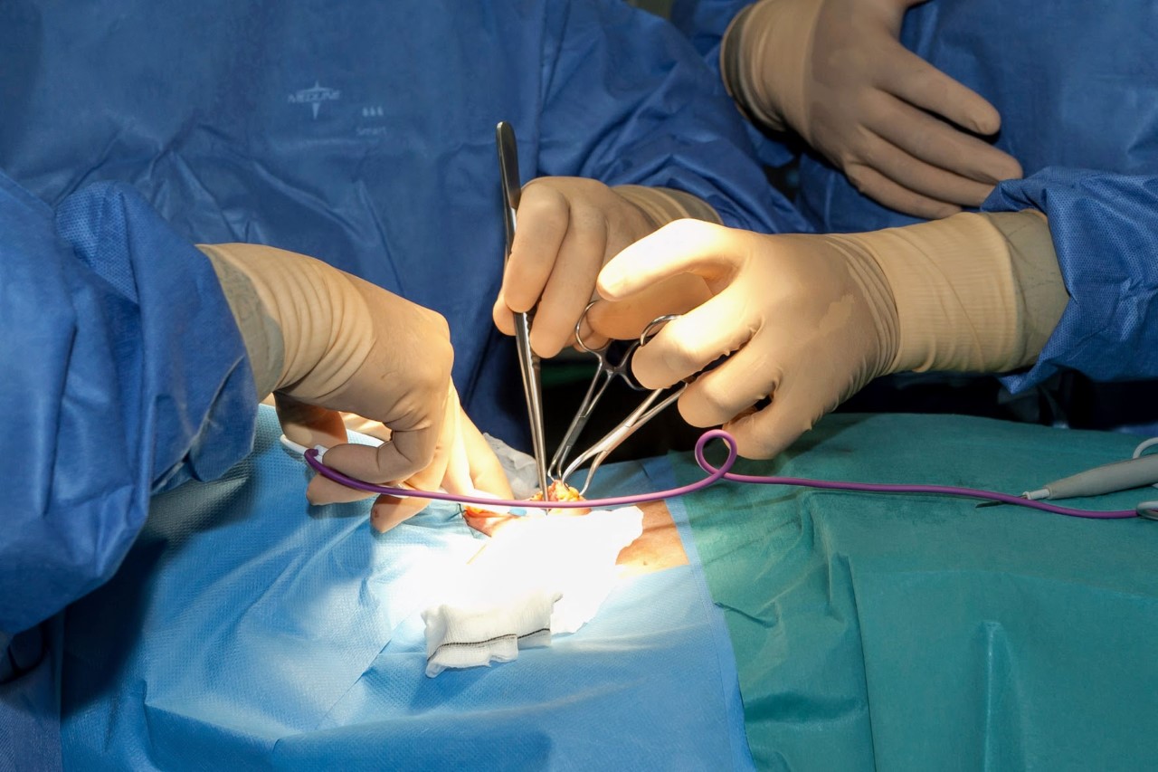 Cirugía de tiroides/ canariasnoticias
