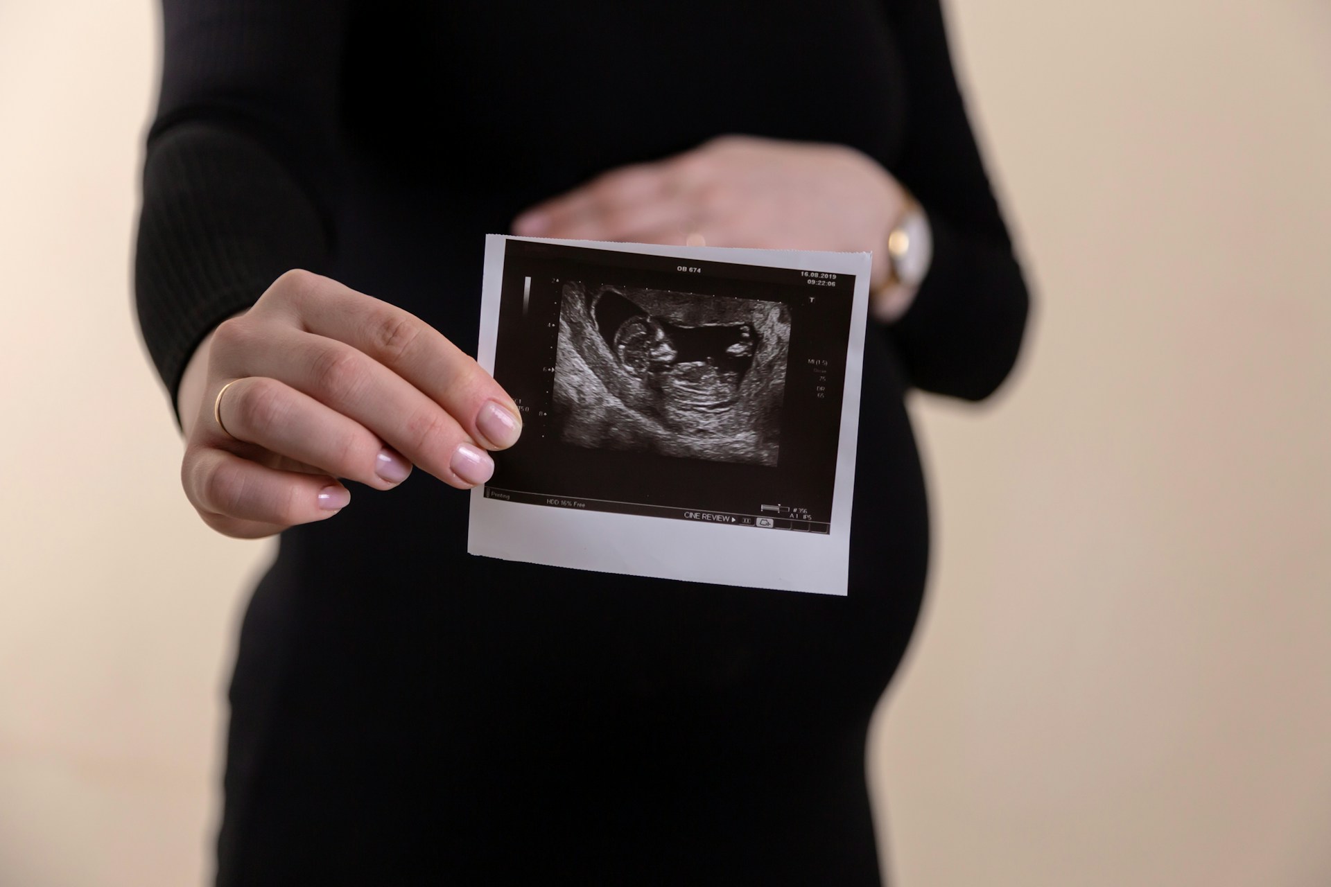 / Volodymyr Hryshchenko (Unsplash) Mujer embarazada sosteniendo ecografía