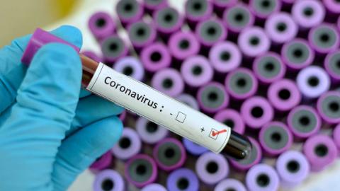 Análisis de coronavirus