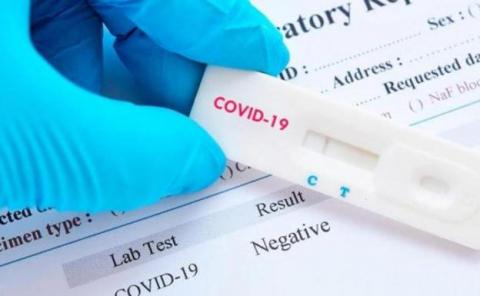 Test antígenos Covid-19 / CanariasNoticias.es Test antígenos Covid-19 / CanariasNoticias.es
