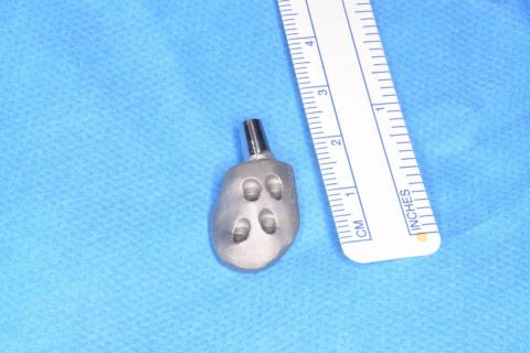 Prótesis maxilofacial Prótesis maxilofacial